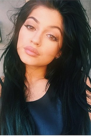 Kylie Jenner Lip Challenge: Worth the Risk?