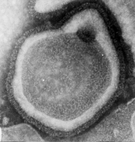 Clark County Washington’s Outbreak of Measles Causes Concern About Vaccination